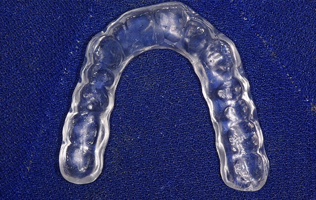 青木歯科の睡眠中の歯ぎしり・食いしばりの治療