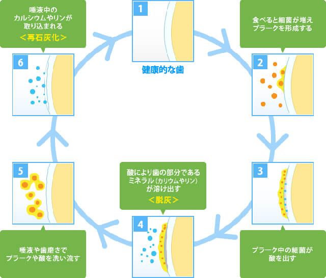 健康な歯の状態