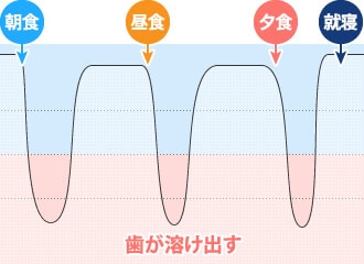 むし歯になりやすい生活習慣1