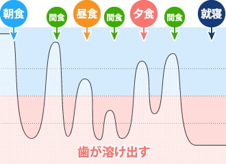 むし歯になりにくい生活習慣2